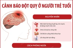 Cảnh báo đột quỵ ở người trẻ tuổi